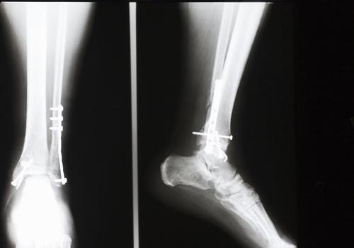 吹空调小腿酸痛什么病 吹空调小腿酸痛是怎么回事