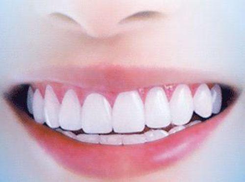 牙菌斑如何去除 黑色的牙菌斑如何去除