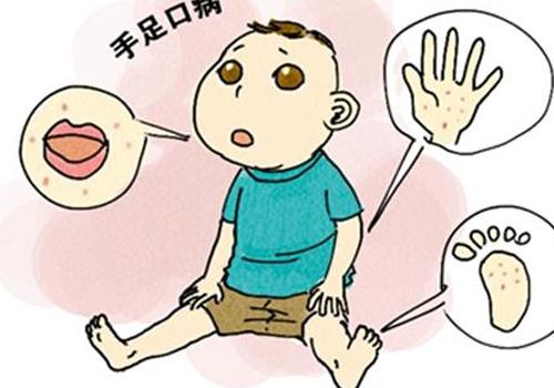 小孩手足口病几天会好 孩子手足口病几天能好啊