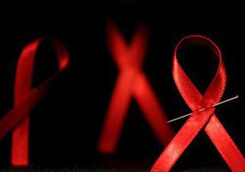 浅表淋巴结肿大是艾滋病吗（浅表淋巴结肿大是艾滋病症状）