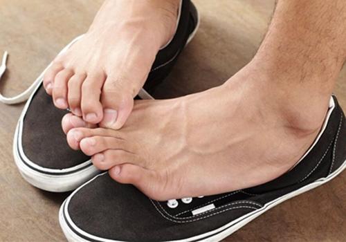 脚气怎么治疗（脚气怎么治疗能除根用什么药膏）