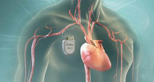 什么人容易得高血压 什么人容易得高血压为什么会得到高血压