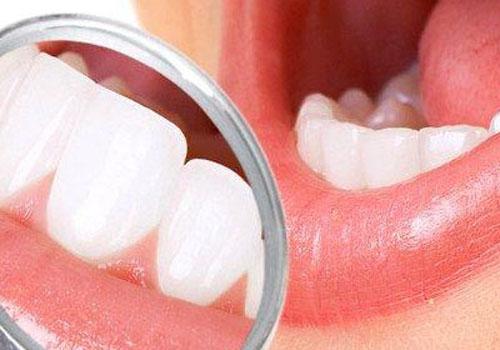 磨牙的危害 做固定牙磨牙的危害