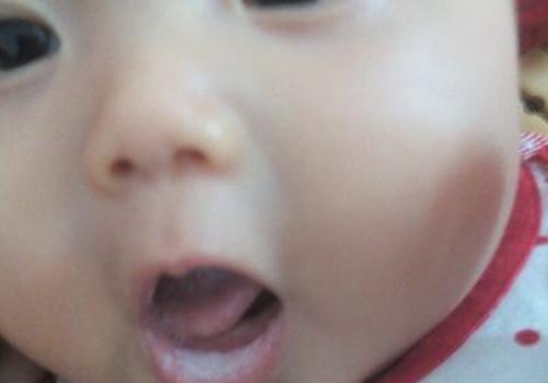 宝宝怎么预防鹅口疮（婴儿怎么预防鹅口疮）