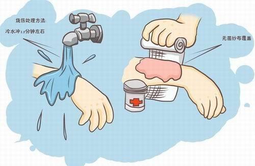 烫伤急救措施及步骤 烫伤急救措施及步骤视频