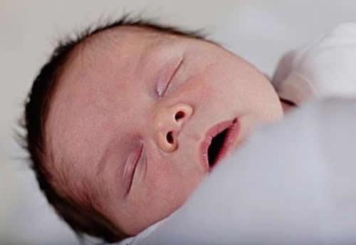 新生儿肺炎的早期症状 新生儿肺炎的早期症状及表现