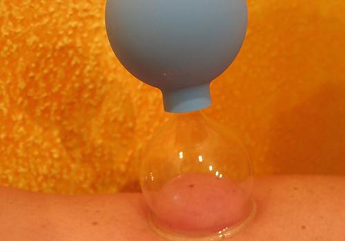 拔罐能调理哪些疾病（拔罐能治病吗,能调理身体吗?）