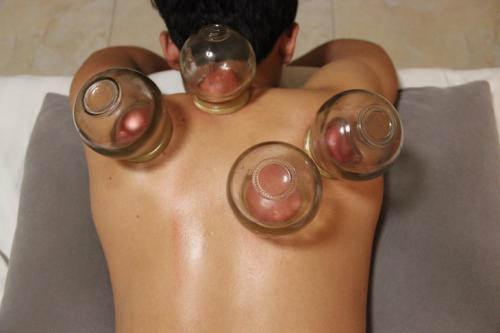 拔罐的作用（拔罐的作用及适用范围）