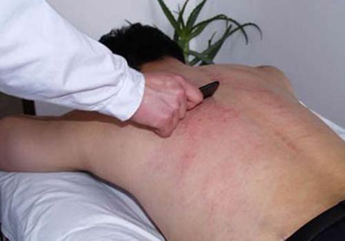 晕刮的原因和处理方法 晕刮的预防