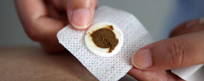 三伏贴可以用来治疗哪些疾病 三伏贴能治什么病?