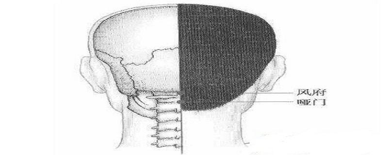 哑门针刺方向（哑门的准确位置图和作用针刺方法）