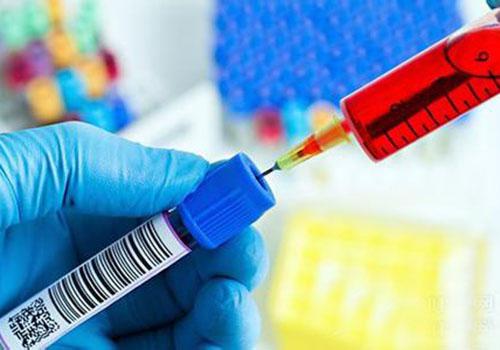 抽血能查出癌症吗 抽血能查出癌症吗?