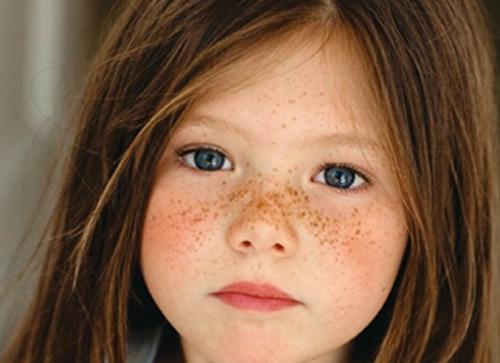 小孩脸上有斑怎么办（小孩脸上有斑怎么办,怎么才能去掉）