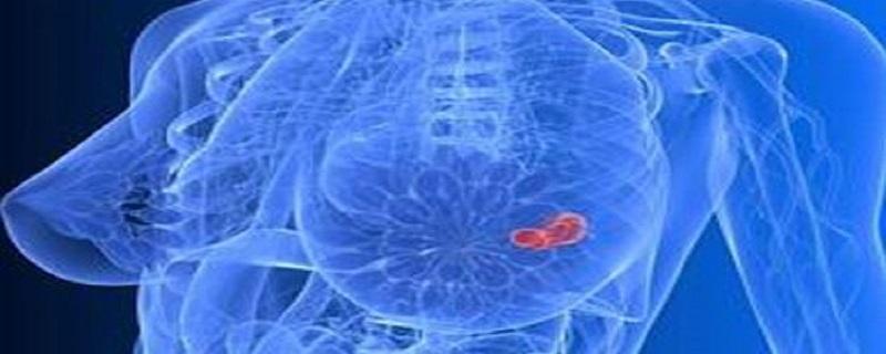 乳腺增生是什么情况(乳腺增生是什么症状)