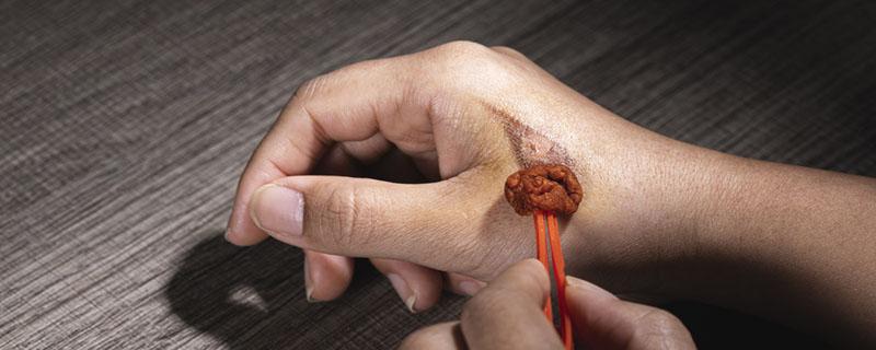 刮伤了能涂田七粉吗（手割破了用三七粉涂抹）