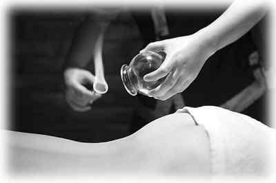 拔罐对身体有什么好处和坏处(拔罐对身体有啥好处吗)