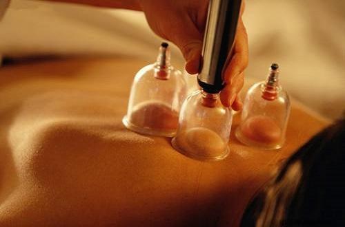 拔罐对胃痛有好处吗（胃疼拔罐好使吗）