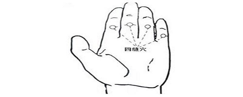 四缝放血的作用(四缝放血的作用视频)