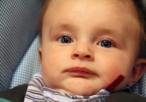 为什么宝宝牙齿长得慢 为什么有些宝宝牙齿长得慢