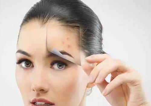 冬天脸上冻红怎么办（冬天冻红的脸怎么办小妙招）