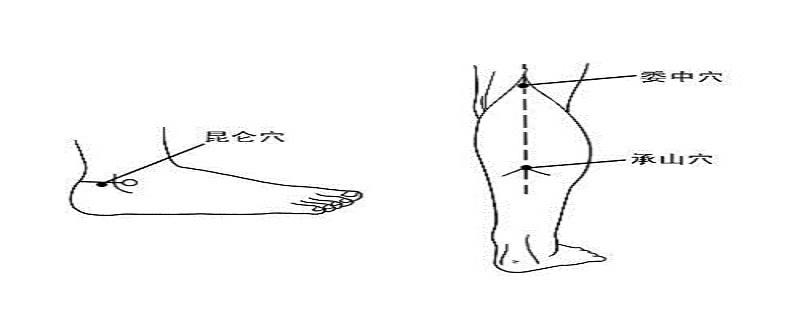 委中针刺方法 针刺委中技巧
