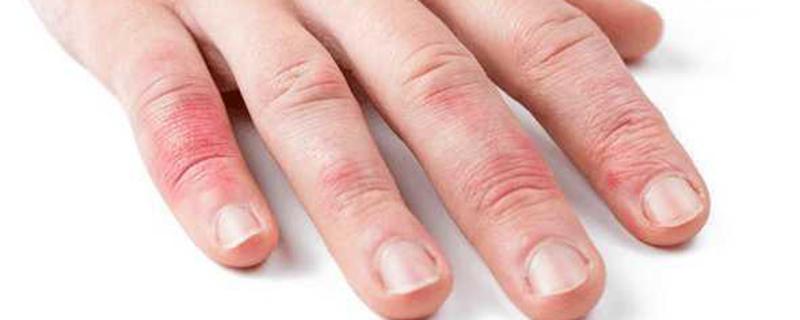 灰指甲穿过的鞋刷完可以穿吗（灰指甲能穿鞋吗）