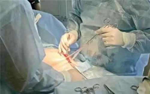 胎儿缺氧孕妇应该如何改善（孕妈如何避免胎儿缺氧）