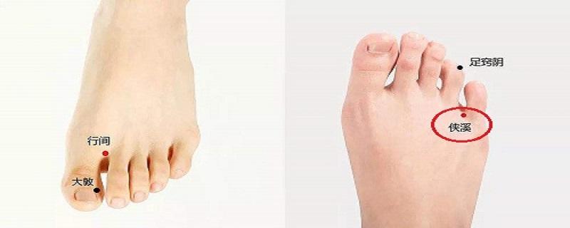 侠溪疼是哪里有问题