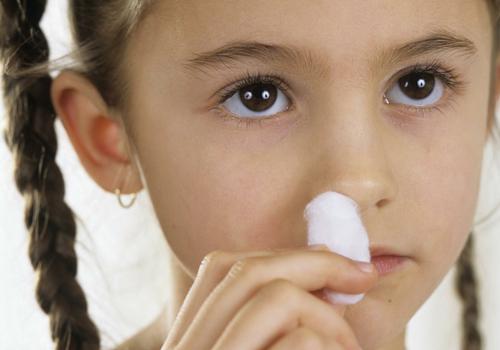 经常流鼻血是白血病吗（6岁孩子经常流鼻血是白血病吗）