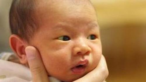 新生儿皮肤黄是什么原因 新生儿皮肤黄是什么原因是缺什么吗