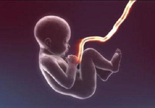 剪脐带是宝宝疼还是妈妈疼 剪脐带是宝宝疼还是妈妈疼脐带剪了放哪