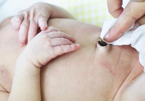 新生儿脐带可以用碘伏消毒吗 新生儿脐带可以不用碘伏消毒吗