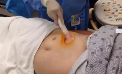 肝穿刺活检是什么意思(肝穿刺是活检吗)