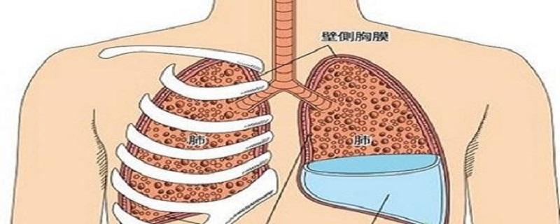 胸腔积液的症状有哪些 胸腔积液的症状有哪些体征