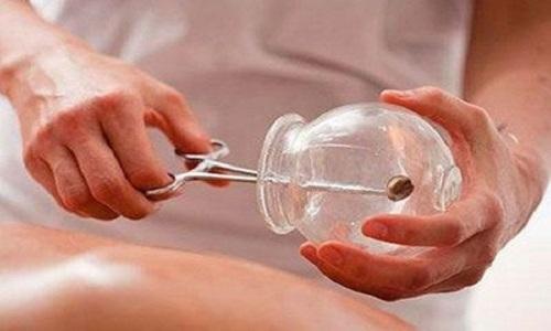 拔罐可以治疗面瘫吗（拔罐能治疗面瘫吗）