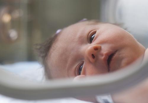 新生儿黄疸降到多少算正常(小儿黄疸降到多少正常)