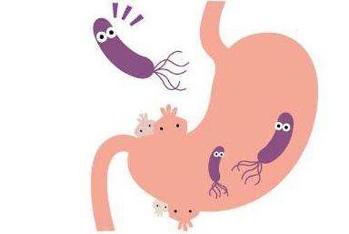 幽门螺杆菌阳性严重吗 幽门螺旋杆菌阳性严重吗