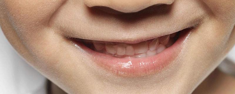 嘴巴动手术会留疤吗 嘴巴为什么不会留疤