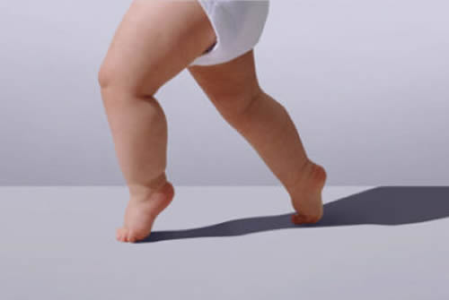 宝宝走路外八字怎么办 宝宝走路外八字怎么办?