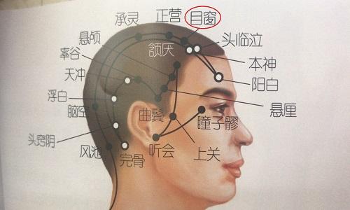 目窗的准确位置图找法 目窗的准确位置图