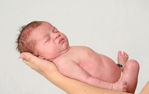 新生儿脐炎怎么治疗 新生儿脐炎如何防治