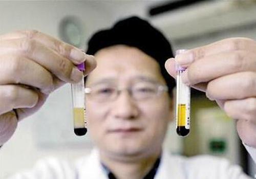 白血病是白细胞过多还是过少（白血病是由于什么细胞过少）