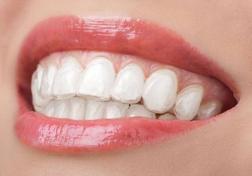 上火牙疼可以拔牙吗 上火牙疼能拔吗