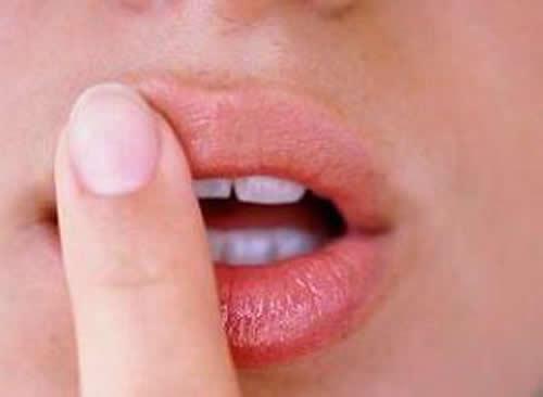 烂嘴角是怎么回事（嘴角烂是什么原因造成的）