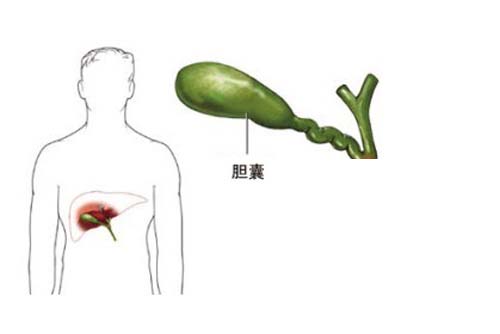 急性胆囊炎饮食注意 慢性胆囊炎饮食注意