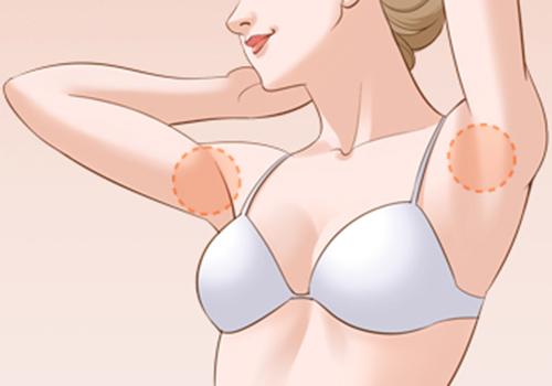 腋臭和油耳朵的关系 为啥油耳朵的人多数都有腋臭啊