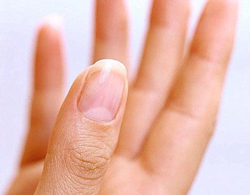 指甲上只有大拇指有月牙代表什么（指甲上只有大拇指有月牙代表什么命运）