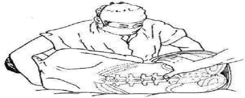 腰穿术的操作过程（腰穿手术过程）