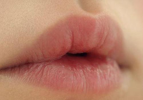 嘴唇上面抠破了怎幺办（嘴唇抠破了怎么办）
