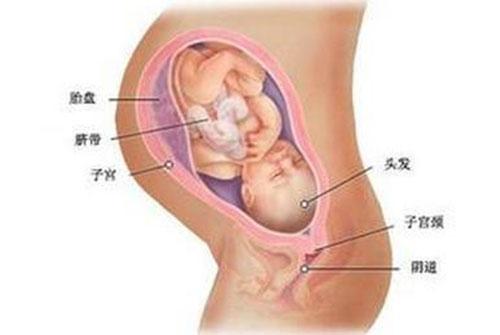 胎盘后置好不好 胎盘后置的原因